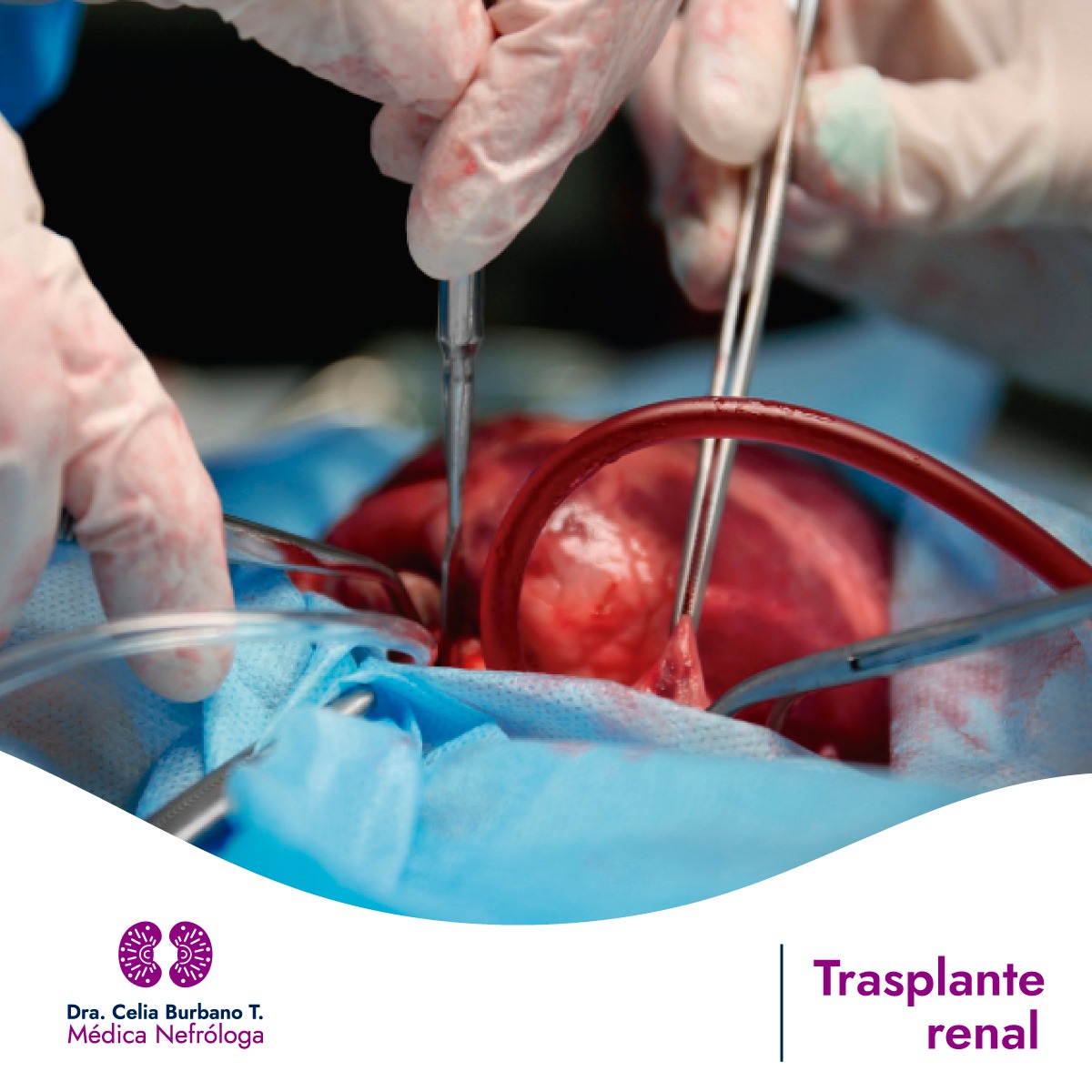 Trasplante renal